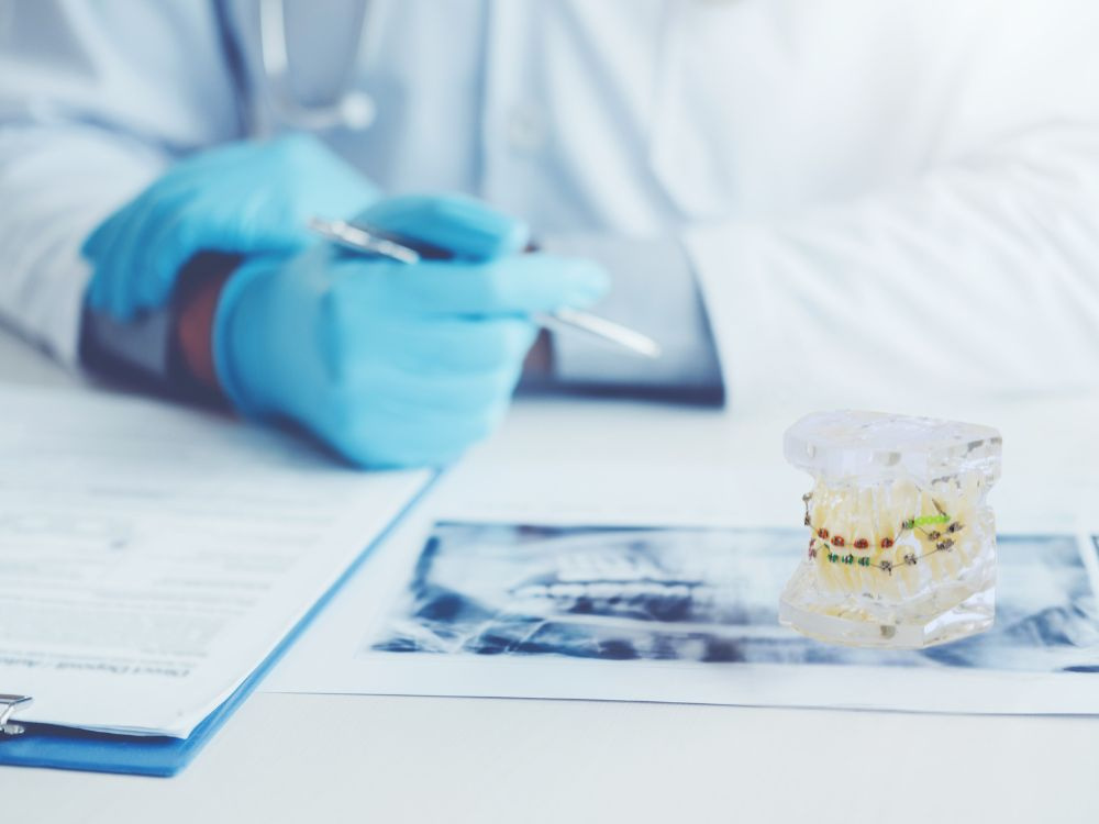 Stomatologinis dantų modelis su ortodontiniu prietaisu
